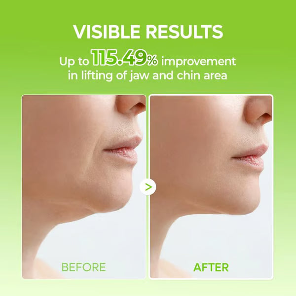 Oveltrix™ Mewing Band (4x Masks Per Pack)